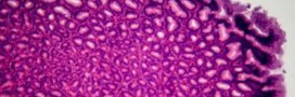 L'Analyse et Réinformation Cellulaire, accélérateur de guérison. Partie 1.