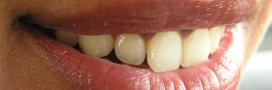 Des astuces écolo contre la mauvaise haleine !