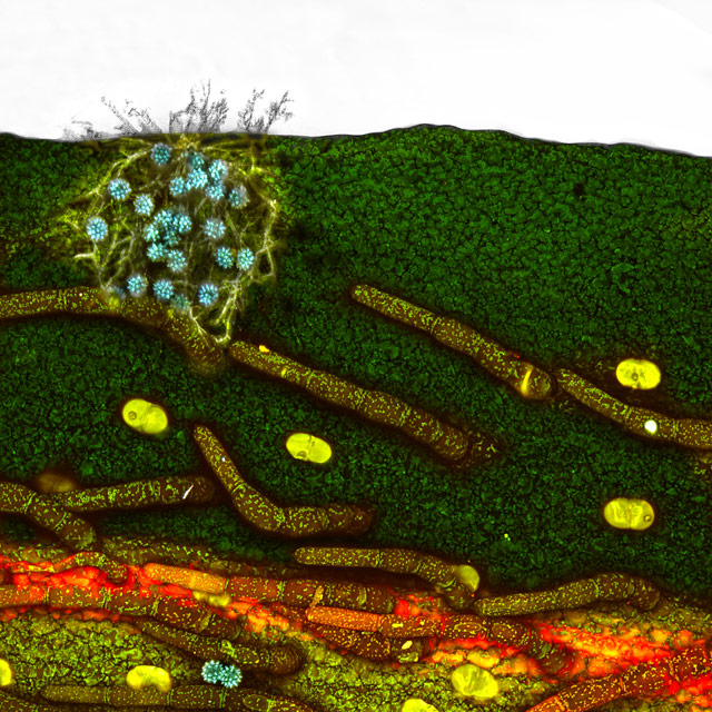 photos au miscroscope infiniment petit sciences small world nikon Photos au microscope Paul_Rigby_daisy-fungus