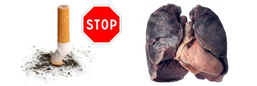 Cigarette : pollution non stop