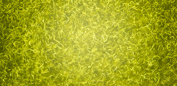 forme microalgue algue klamath