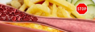 Comment faire baisser mon cholestérol ? Comment faire baisser mon cholestérol ?