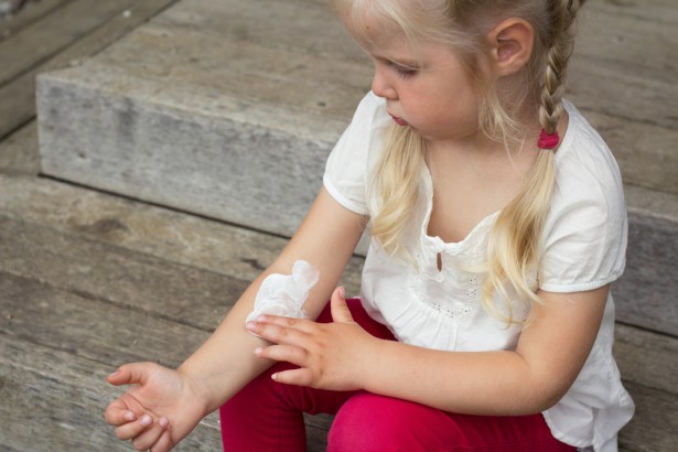 lutter contre l'eczéma des enfants