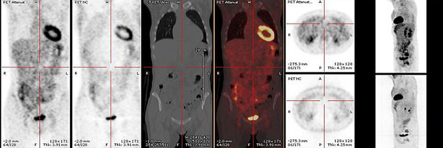 Que sait-on de la radioactivité lors du diagnostic médical ?