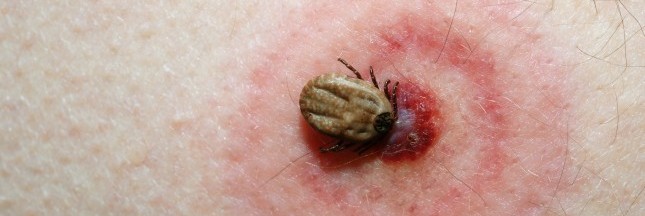tiques, maladie de Lyme