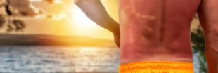 Coup de chaleur, coup de soleil : attention, danger !