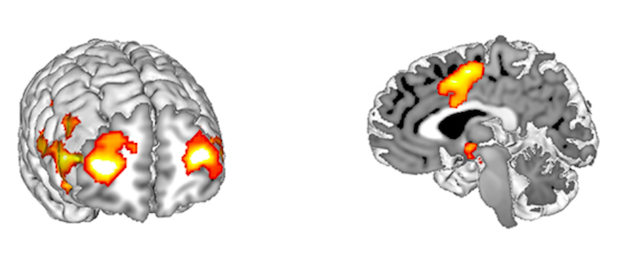 opinion scan cerveau