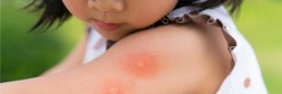 Alerte sanitaire : un 'super paludisme' déferle en Asie