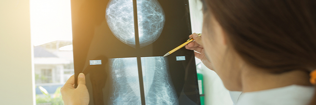 Cancer du sein : réalise-t-on trop de mammographies ?