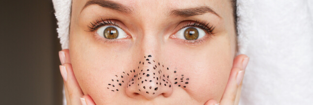 12 Conseils Pour Lutter Contre Les Points Noirs Et Les Pores Dilates Au Naturel
