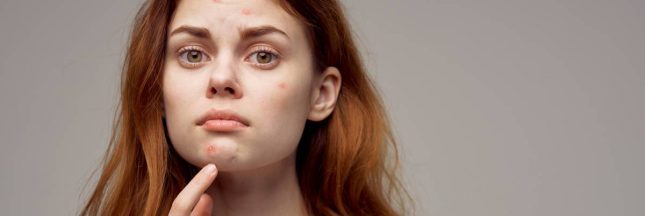 lutter contre l'acné