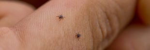 Piqué·e par un tique ? Aidez la recherche clinique pour améliorer le diagnostic des maladies du tique Piqué·e par un tique ? Aidez la recherche clinique pour améliorer le diagnostic des maladies du tique