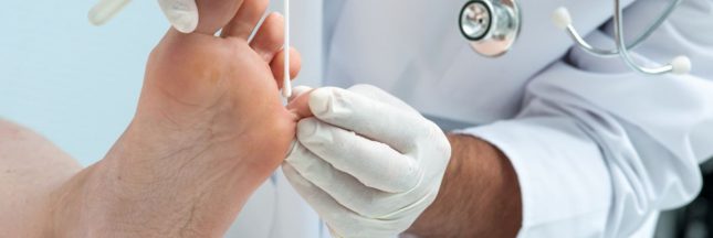 Une mycose des pieds ou pieds d'athlète