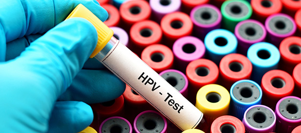 test HPV cancer de l'utérus
