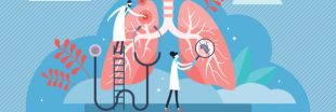 Immunothérapie, thérapies ciblées : les nouveaux traitements du cancer du poumon