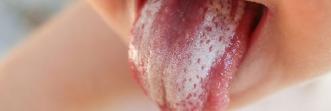 Remèdes naturels pour soigner le muguet du bébé
