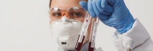 Covid-19 : où se faire dépister et à quelles conditions ?