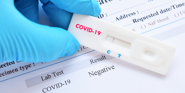 covid-19 test antigénique