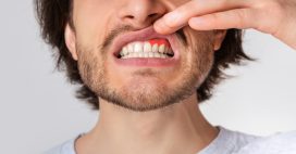 Gencive gonflée ? Causes et meilleurs remèdes naturels Gencive gonflée ? Causes et meilleurs remèdes naturels