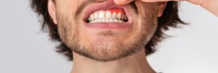 Gencive gonflée ? Causes et meilleurs remèdes naturels