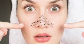 12 conseils pour lutter contre les points noirs et les pores dilatés au naturel 12 conseils pour lutter contre les points noirs et les pores dilatés au naturel