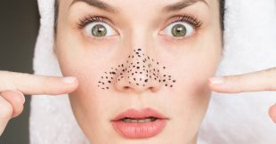 12 conseils pour lutter contre les points noirs et les pores dilatés au naturel