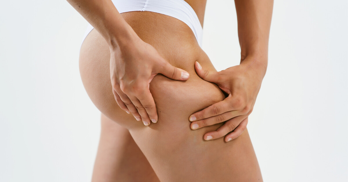 Alimentation anti-cellulite : quels aliments et ingrédients privilégier ?