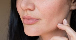 Peau sèche : les solutions naturelles pour la nourrir Peau sèche : les solutions naturelles pour la nourrir