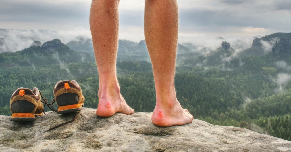 Une ampoule aux mains ou au pied, que faire