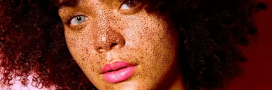 Skin positive : et si on affichait notre peau avec ses imperfections ?