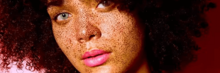 Skin positive : et si on affichait notre peau avec ses imperfections ?