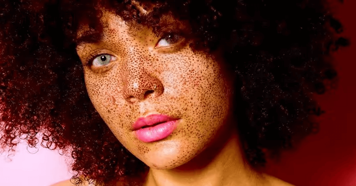 Skin positive : et si on affichait notre peau avec ses imperfections ?