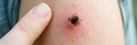 Maladie de Lyme : l&rsquo;argent colloïdal, un traitement prometteur
