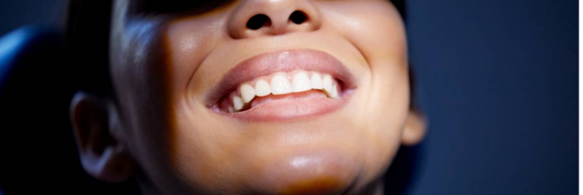 blanchiement dentaire