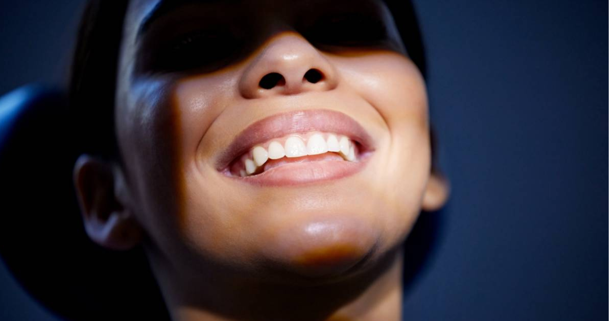 Que faut-il savoir avant de faire un blanchiment dentaire ?