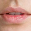 Lèvres gercées : 5 mauvaises habitudes à bannir pour les éviter