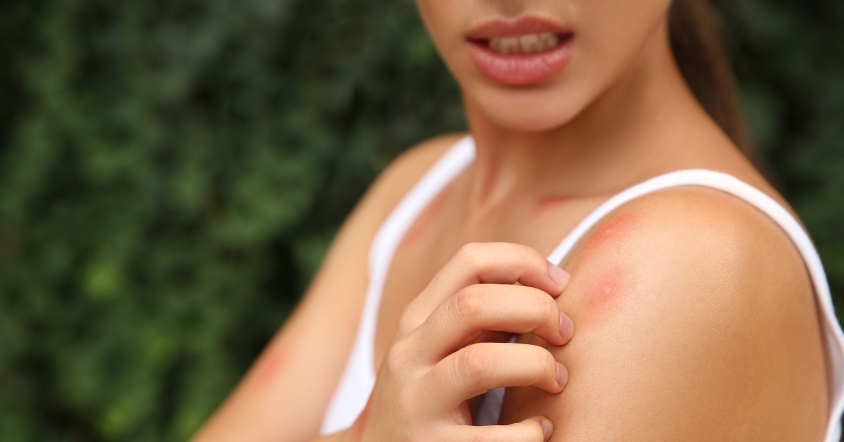 Pourquoi les moustiques dévorent toujours les mêmes personnes ?