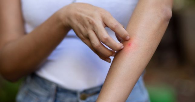 Pour repousser les moustiques, préférez ces couleurs de vêtement