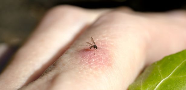 Que faire en cas d'allergie aux piqûres de moustiques ?