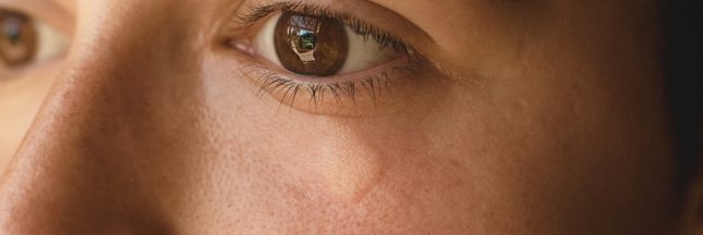 piqûre de guêpe à l'oeil