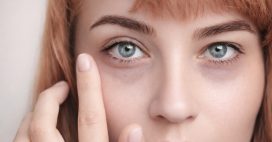 Cernes et poches sous les yeux : des solutions naturelles pour retrouver un regard frais