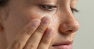 Peau sèche : les solutions naturelles pour la nourrir