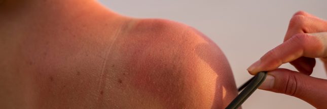 l'antisunscreen danger sur les réseaux sociaux