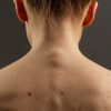 Comment savoir si un grain de beauté est suspect ? Comment savoir si un grain de beauté est suspect ?