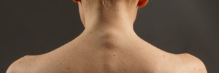 Comment savoir si un grain de beauté est suspect ? Comment savoir si un grain de beauté est suspect ?