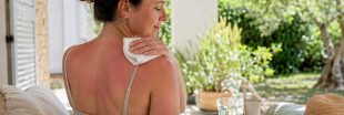 Les astuces pour soigner un coup de soleil naturellement Les astuces pour soigner un coup de soleil naturellement