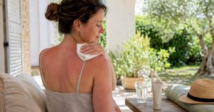 Les astuces pour soigner un coup de soleil naturellement