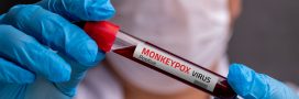 Mpox : voici ce qu’il faut savoir aujourd’hui Mpox : voici ce qu’il faut savoir aujourd’hui