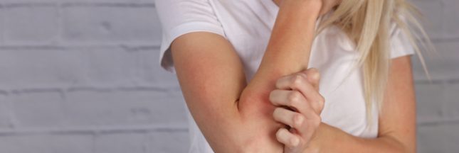 Pourquoi il ne faut pas gratter votre eczéma