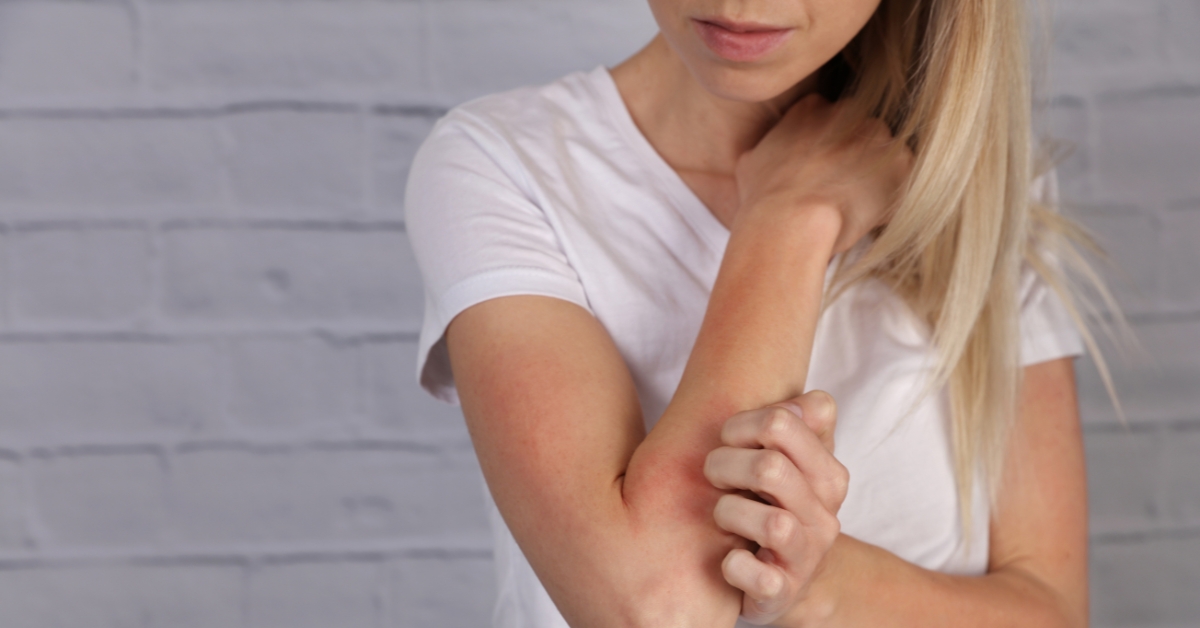 Pourquoi il ne faut pas gratter votre eczéma